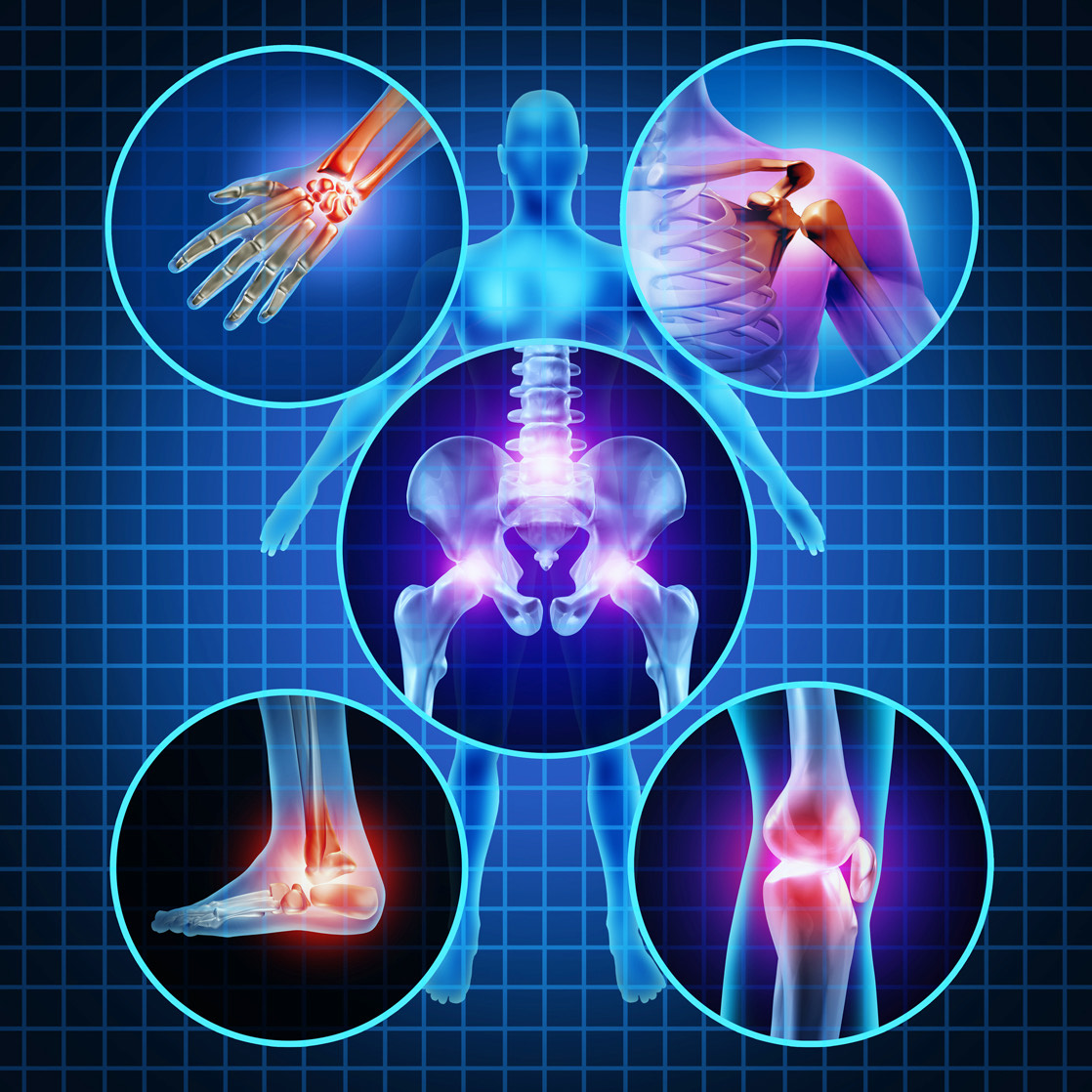 pain joints.jpg